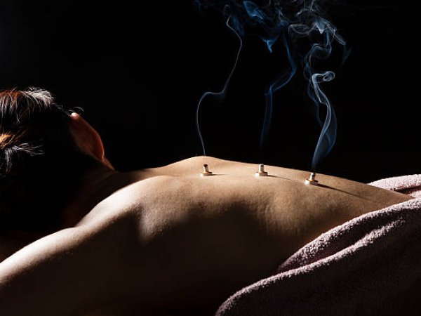 Moxibustion